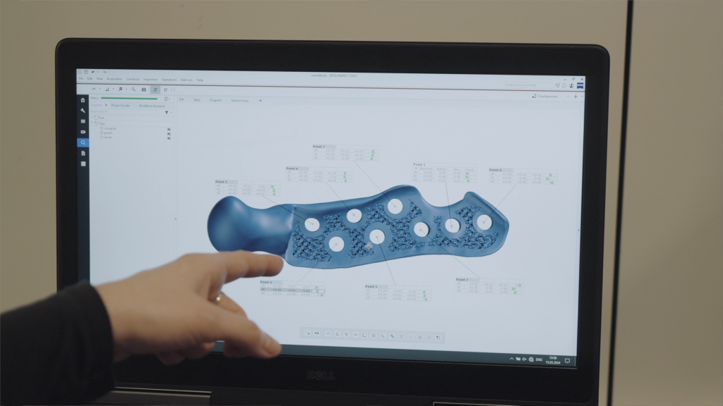 CADskills checks the quality of the scanned implant